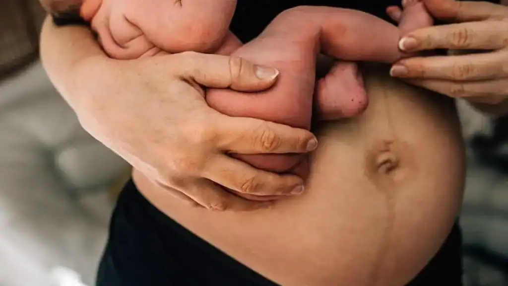 Why Is My Stomach Still Big After Pregnancy Bexleyhill?